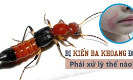 Kiến ba khoang t&#225;i xuất, b&#225;c sĩ khuy&#234;n kh&#244;ng n&#234;n ch&#224; x&#225;t, &quot;giết&quot; kiến