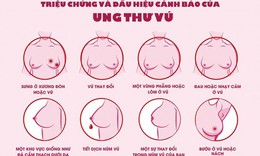 Ph&#225;t hiện sớm ung thư v&#250;, tỉ lệ chữa khỏi bệnh c&#224;ng cao
