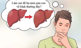 Tho&#225;t khỏi men gan cao