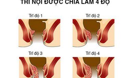 L&#224;m thế n&#224;o để đẩy l&#249;i bệnh trĩ nội hiệu quả