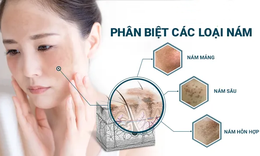 Những &#39;vương dược&#39; d&#224;nh cho chị em l&#224;m s&#225;ng, đẹp da