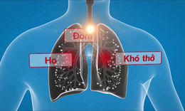 4 yếu tố then chốt ổn định hen phế quản