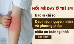 Nổi mề đay ở trẻ em: Dấu hiệu v&#224; c&#225;ch chữa an to&#224;n gi&#250;p b&#233; hết mẩn ngứa