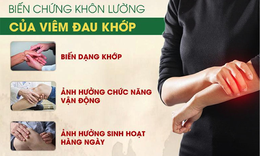 Sản phẩm thảo dược cải thiện bệnh khớp t&#225;i ph&#225;t hiệu quả