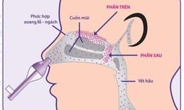Phương ph&#225;p rửa mũi mới - bước tiến mới trong ph&#242;ng chống bệnh đường h&#244; hấp ở trẻ