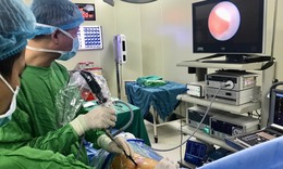 Tán sỏi qua da: Phương pháp hiện đại, hạn chế đau đớn cho bệnh nhân