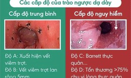 Lời khuy&#234;n cho người bệnh tr&#224;o ngược dạ d&#224;y thực quản