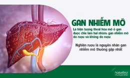 Gan nhiễm mỡ - bệnh từ những th&#243;i quen xấu