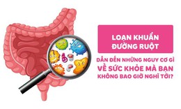 Loạn khuẩn đường ruột dẫn đến những nguy cơ về sức khỏe m&#224; &#237;t nghĩ tới