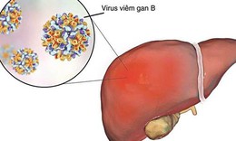 Giải ph&#225;p hỗ trợ kiểm so&#225;t virus hiệu quả cho người vi&#234;m gan B