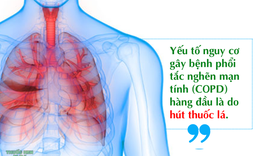 Phổi tắc nghẽn mạn t&#237;nh l&#224; g&#236;? Nguy&#234;n nh&#226;n, triệu chứng, c&#225;ch điều trị