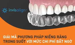 Niềng răng trong suốt Invisalign gi&#225; bao nhi&#234;u?