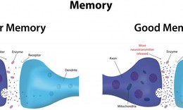 Bệnh suy giảm tr&#237; nhớ v&#224; giải ph&#225;p cải thiện hiệu quả