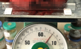 Nghi ngờ b&#233;o bụng, người phụ nữ c&#243; khối u khủng nặng 6kg