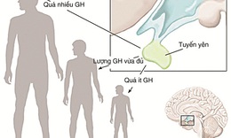 Ho&#243;c-m&#244;n tăng trưởng: C&#244;ng dụng v&#224; hệ lụy