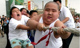 Chóng mặt: Số trẻ bị béo phì tăng gấp 10 lần chỉ sau 40 năm