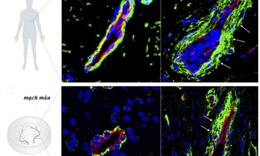 Đột ph&#225; mới: Nu&#244;i th&#224;nh c&#244;ng mạch m&#225;u người trong ph&#242;ng th&#237; nghiệm