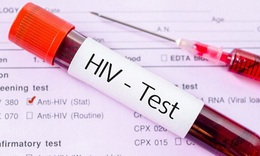 HIV c&#243; thể lan truyền từ n&#227;o bộ