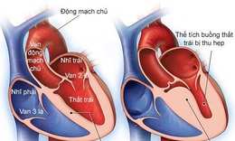 Loại thuốc mới c&#243; thể gi&#250;p cải thiện chức năng tim