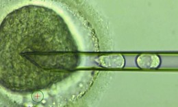 Kỹ thuật thụ tinh nh&#226;n tạo lấy DNA “3 người” được chứng minh an to&#224;n