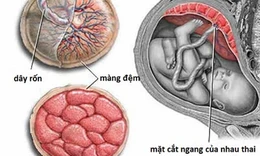 Nhau thai gi&#250;p chẩn đo&#225;n bệnh tật của thai nhi