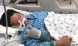 Nữ sinh 15 tuổi sốt nhẹ, đau họng... sau 2 tuần bị yếu liệt  to&#224;n th&#226;n