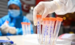Đà Nẵng tri&#234;̉n khai x&#233;t nghi&#234;̣m SARS-CoV-2 cho người lao đ&#244;̣ng