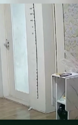 Khoảnh khắc thót tim cô gái khuỵu ngã sau khi đứng dậy, bác sĩ cảnh báo