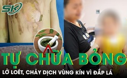 B&#233; 2 tuổi lở lo&#233;t chảy dịch v&#249;ng k&#237;n v&#236; bố mẹ tự đắp l&#225; chữa bỏng tại nh&#224;