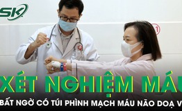 X&#233;t nghiệm m&#225;u bất ngờ ph&#225;t hiện c&#243; t&#250;i ph&#236;nh mạch m&#225;u n&#227;o dọa vỡ