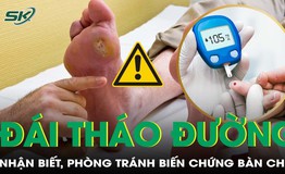 Biến chứng b&#224;n ch&#226;n tiểu đường: nhận biết để ph&#242;ng ngừa!