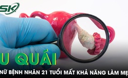 Mất khả năng l&#224;m mẹ do khối u qu&#225;i c&#243; chứa xương, răng v&#224; t&#243;c
