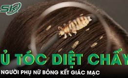 Bỏng kết gi&#225;c mạc sau khi ủ t&#243;c diệt chấy