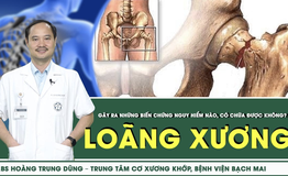 Lo&#227;ng xương: Những biến chứng nguy hiểm v&#224; c&#225;ch ph&#242;ng ngừa