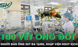 Hơn 100 vết ong v&#242; vẽ đốt khiến người đ&#224;n &#244;ng suy đa tạng, nhập viện nguy kịch