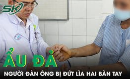 Cứu người đ&#224;n &#244;ng 40 tuổi bị đứt l&#236;a hai b&#224;n tay sau vụ ẩu đả với h&#224;ng x&#243;m