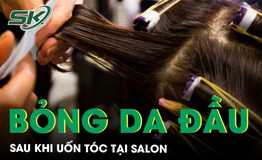 Nữ kh&#225;ch h&#224;ng bỏng da đầu sau khi uốn t&#243;c tại salon