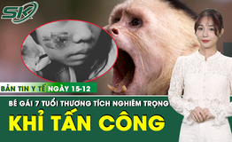 Bản tin Y tế 15/12: Bé gái 7 tuổi thương tích nghiêm trọng do bị khỉ hoang tấn công