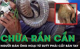 Chữa rắn cắn bằng thuốc nam, người đ&#224;n &#244;ng su&#253;t mất b&#224;n tay 
