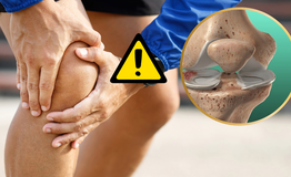 Bỏ qua cơn đau gối sau tai nạn thể thao, nam thanh ni&#234;n su&#253;t t&#224;n phế 