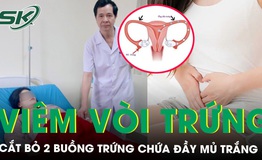 Chủ quan với vi&#234;m mủ v&#242;i trứng, người phụ nữ phải cắt bỏ cả 2 buồng trứng