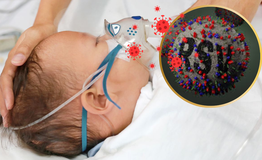 B&#233; 9 th&#225;ng tuổi thoi th&#243;p phải thở m&#225;y v&#236; nhiễm virus từ nụ h&#244;n của người lớn