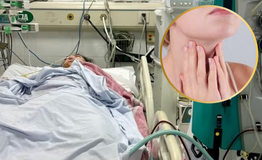 Sốt, đau họng tưởng cảm c&#250;m, nữ sinh nguy kịch chỉ sau một ng&#224;y nhập viện