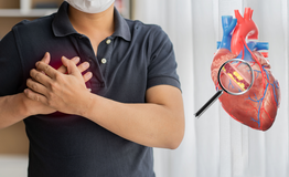 35 tuổi bị nhồi m&#225;u cơ tim sau dấu hiệu tức ngực, kh&#243; thở