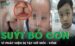 Su&#253;t kh&#244;ng được ch&#224;o đời v&#236; dị tật hở m&#244;i, b&#233; trai trở th&#224;nh niềm tự h&#224;o của gia đ&#236;nh