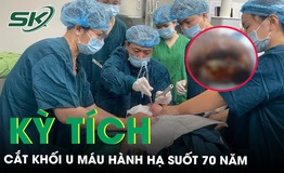 Giải tho&#225;t cho người phụ nữ khỏi khối u m&#225;u đeo b&#225;m suốt 70 năm