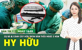 Bản Tin Y Tế 16/5: Cụ b&#224; bị c&#224;nh c&#226;y d&#224;i hơn 20cm đ&#226;m thấu ngực hơn 2 năm kh&#244;ng hề biết