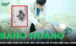 Đau lưng nhưng chủ quan, người phụ nữ kh&#244;ng ngờ thận đ&#227; ứ mủ, đầy sỏi san h&#244; 