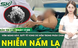 Bản tin Y tế 17/5: Nam bệnh nh&#226;n su&#253;t tử vong v&#236; vi&#234;m m&#224;ng n&#227;o hiếm gặp do nhiễm nấm lạ 

