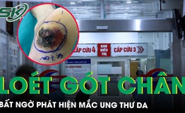 Lo&#233;t g&#243;t ch&#226;n k&#233;o d&#224;i 6 th&#225;ng bất ngờ ph&#225;t hiện mắc ung thư da